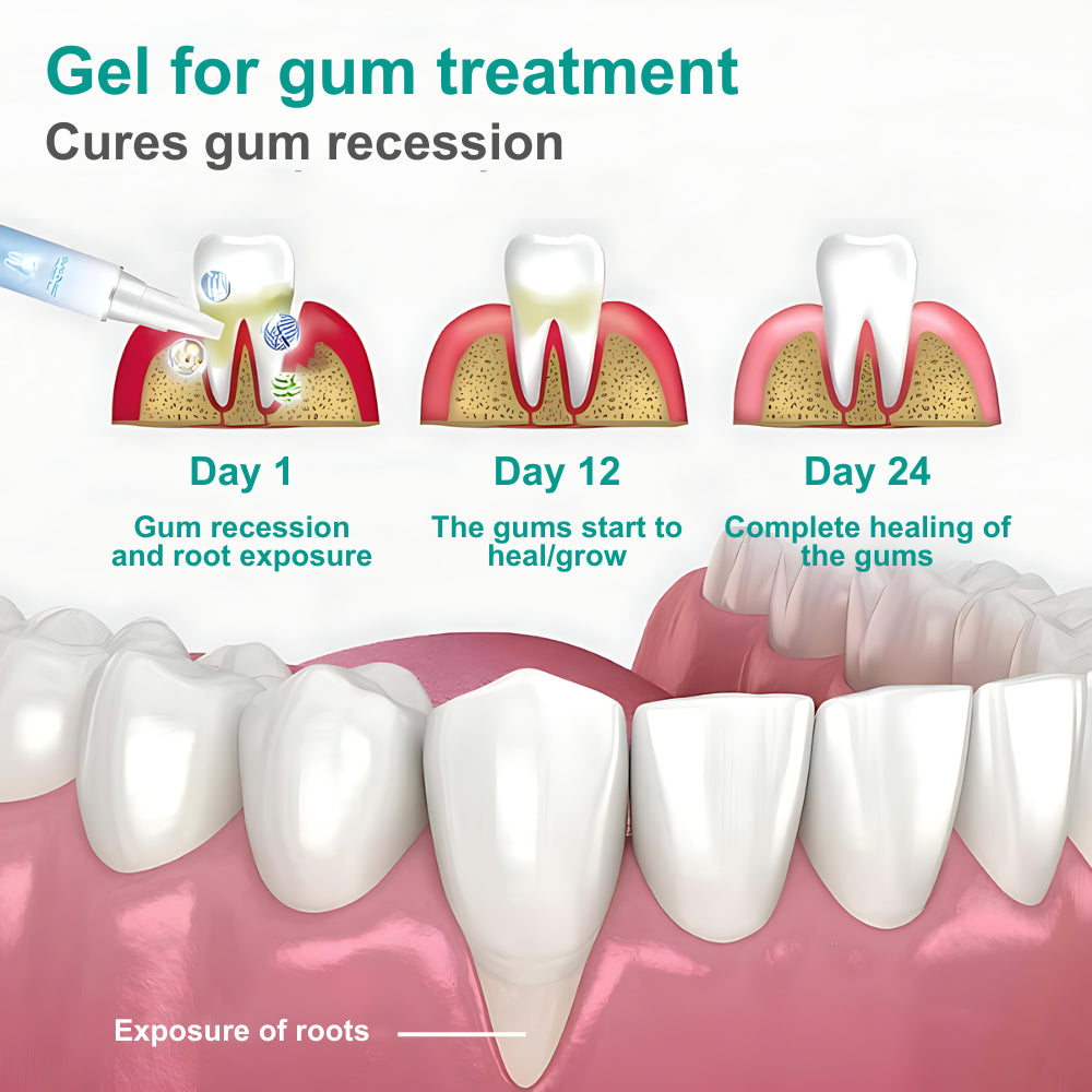 Applying Soothe along the gum line